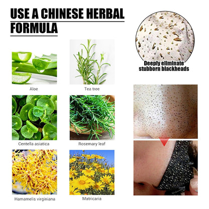 Deep Cleaning Facial Mask